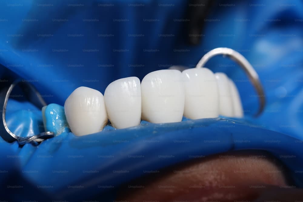 Dental implant before and after