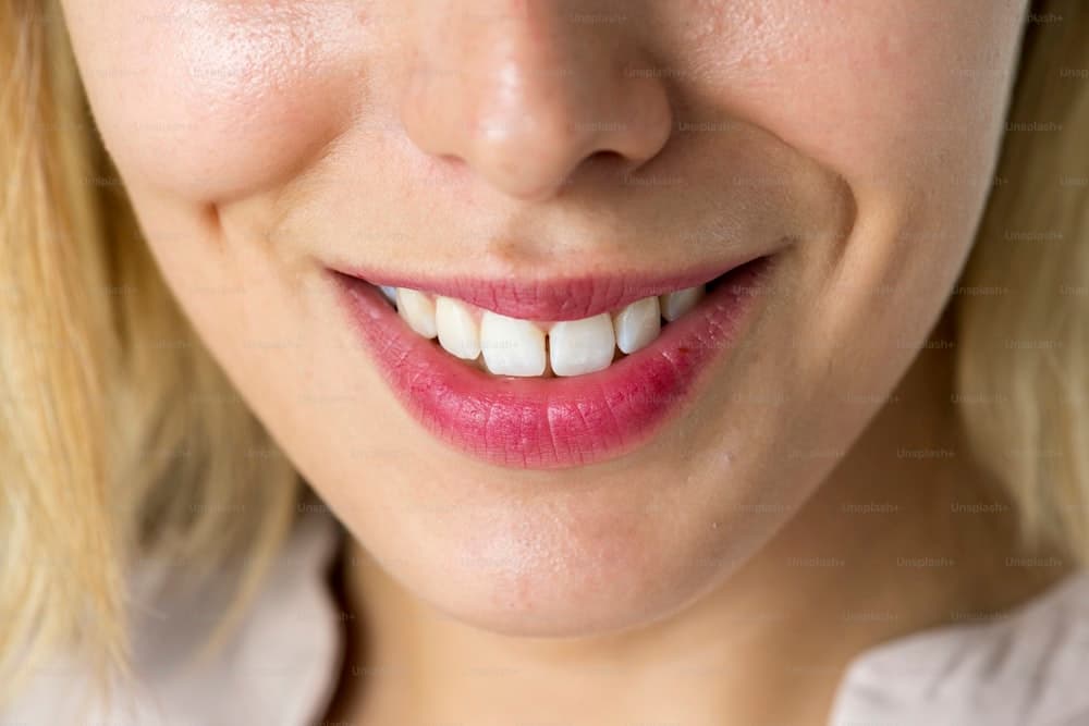 Professional whitening results