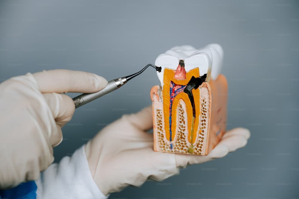 CEREC same-day crown machine